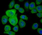 S100A8 Antibody in Immunocytochemistry (ICC/IF)