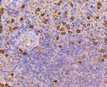 S100A8 Antibody in Immunohistochemistry (Paraffin) (IHC (P))