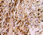 S100A8 Antibody in Immunohistochemistry (Paraffin) (IHC (P))