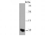 S100A8 Antibody in Western Blot (WB)