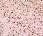 NFIB Antibody in Immunohistochemistry (Paraffin) (IHC (P))