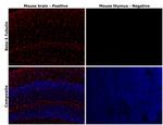 beta-3 Tubulin Antibody in Immunohistochemistry (Paraffin) (IHC (P))