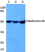 beta-3 Tubulin Antibody in Western Blot (WB)