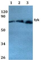 Syk Antibody in Western Blot (WB)