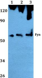 Fyn Antibody in Western Blot (WB)