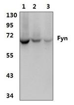 Fyn Antibody in Western Blot (WB)