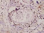 PKC alpha Antibody in Immunohistochemistry (Paraffin) (IHC (P))