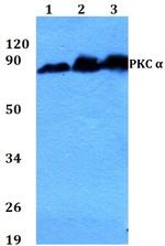 PKC alpha Antibody in Western Blot (WB)