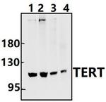 TERT Antibody in Western Blot (WB)