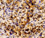 S100A8 Antibody in Immunohistochemistry (Paraffin) (IHC (P))