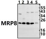 S100A8 Antibody in Western Blot (WB)