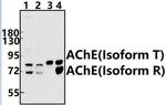 Acetylcholinesterase Antibody in Western Blot (WB)