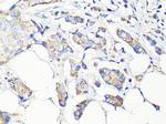 Beclin 1 Antibody in Immunohistochemistry (Paraffin) (IHC (P))