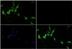 SQSTM1 Antibody in Immunohistochemistry (Paraffin) (IHC (P))