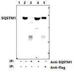 SQSTM1 Antibody in Western Blot (WB)