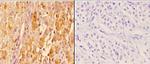 14-3-3 zeta Antibody in Immunohistochemistry (Paraffin) (IHC (P))