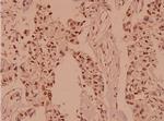 Protein APC Antibody in Immunohistochemistry (Paraffin) (IHC (P))