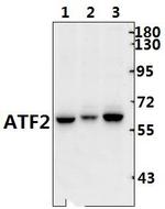 ATF2 Antibody in Western Blot (WB)