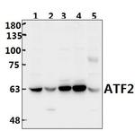 ATF2 Antibody in Western Blot (WB)