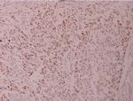 ATF2 Antibody in Immunohistochemistry (Paraffin) (IHC (P))