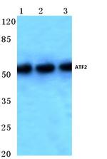 ATF2 Antibody in Western Blot (WB)