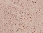 ATF4 Antibody in Immunohistochemistry (Paraffin) (IHC (P))