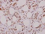 Bcl-X Antibody in Immunohistochemistry (Paraffin) (IHC (P))