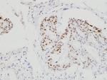 C/EBP beta Antibody in Immunohistochemistry (Paraffin) (IHC (P))