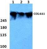 COL4A1 Antibody in Western Blot (WB)