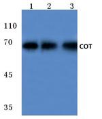 TPL2 Antibody in Western Blot (WB)