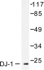 DJ-1 Antibody in Western Blot (WB)
