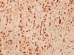 DNA-PK Antibody in Immunohistochemistry (Paraffin) (IHC (P))