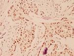 DP1 Antibody in Immunohistochemistry (Paraffin) (IHC (P))