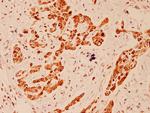 EEF2 Antibody in Immunohistochemistry (Paraffin) (IHC (P))