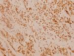 FANCD2 Antibody in Immunohistochemistry (Paraffin) (IHC (P))