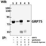 HSPA9 Antibody in Immunoprecipitation (IP)