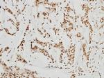 HDAC8 Antibody in Immunohistochemistry (Paraffin) (IHC (P))