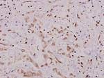 IKK alpha Antibody in Immunohistochemistry (Paraffin) (IHC (P))