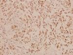 Involucrin Antibody in Immunohistochemistry (Paraffin) (IHC (P))