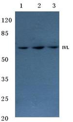 Involucrin Antibody in Western Blot (WB)