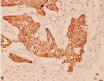 Cytokeratin 20 Antibody in Immunohistochemistry (Paraffin) (IHC (P))