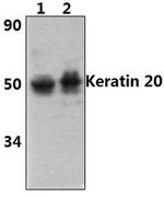 Cytokeratin 20 Antibody in Western Blot (WB)