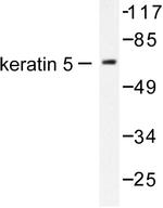 Cytokeratin 5 Antibody in Western Blot (WB)