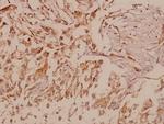 MMP16 Antibody in Immunohistochemistry (Paraffin) (IHC (P))