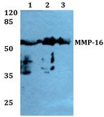 MMP16 Antibody in Western Blot (WB)