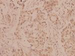 MMP8 Antibody in Immunohistochemistry (Paraffin) (IHC (P))