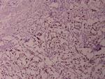 NFkB p52 Antibody in Immunohistochemistry (Paraffin) (IHC (P))