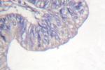 PLCG1 Antibody in Immunohistochemistry (Paraffin) (IHC (P))