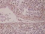 PML Antibody in Immunohistochemistry (Paraffin) (IHC (P))