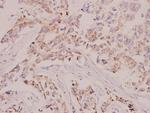 c-Raf Antibody in Immunohistochemistry (Paraffin) (IHC (P))